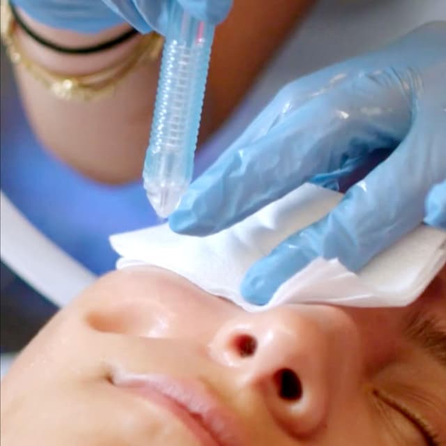 Breeze Correction Series-4 Pack at The Glow Lab in Waterville, ME