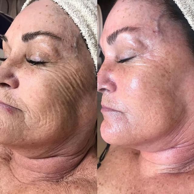 Breeze Bright & Tight at The Glow Lab in Waterville, ME